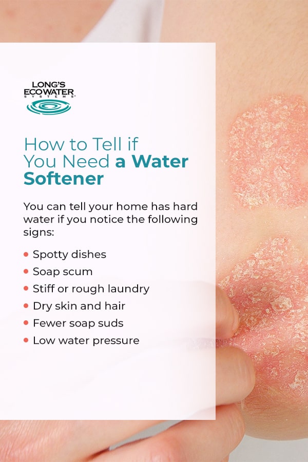 How to Tell if You Need a Water Softener